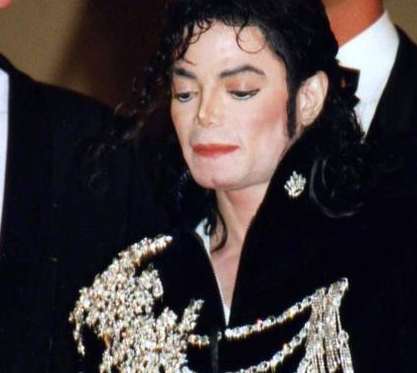 Fear over outbreak of Michael Jackson's skin condition in Nigeria Fear over outbreak of Michael Jackson's skin condition in Nigeria